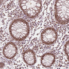 Immunohistochemical staining of human colon shows moderate to strong nuclear positivity in glandular cells.