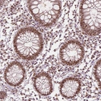 Immunohistochemical staining of human colon shows moderate to strong nuclear positivity in glandular cells.