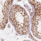 Immunohistochemical staining of human testis shows moderate to strong nuclear positivity in cells in seminiferous ducts.