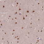 Immunohistochemical staining of human cerebral cortex shows strong nuclear positivity in neurons.