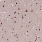 Immunohistochemical staining of human cerebral cortex shows strong nuclear positivity in neurons.