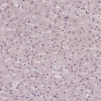 Immunohistochemical staining of human liver shows no positivity in hepatocytes as expected.