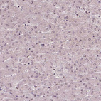 Anti-NSD2 Antibody