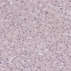 Immunohistochemical staining of human liver shows no positivity in hepatocytes as expected.