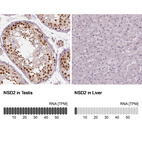 Anti-NSD2 Antibody