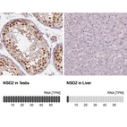 Anti-NSD2 Antibody