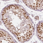 Immunohistochemical staining of human testis shows moderate to strong nuclear positivity in cells in seminiferous ducts.