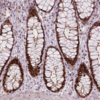 Anti-NSD2 Antibody