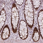 Immunohistochemical staining of human rectum shows strong nuclear positivity in glandular cells.