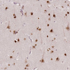 Immunohistochemical staining of human cerebral cortex shows strong nuclear positivity in neurons.