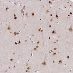 Immunohistochemical staining of human cerebral cortex shows strong nuclear positivity in neurons.