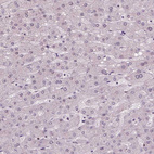 Anti-NSD2 Antibody