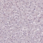 Immunohistochemical staining of human liver shows no positivity in hepatocytes as expected.
