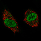 Anti-NSD2 Antibody