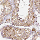 Anti-RHOT1 Antibody