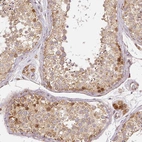 Immunohistochemical staining of human testis shows moderate cytoplasmic positivity in cells in seminiferous ducts.