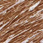 Immunohistochemical staining of human heart muscle shows strong cytoplasmic positivity in cardiomyocytes.