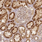 Immunohistochemical staining of human kidney shows moderate to strong cytoplasmic positivity in cells in tubules.