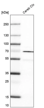 Western blot analysis in human cerebral cortex tissue.