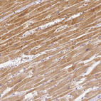 Immunohistochemical staining of human heart muscle shows moderate cytoplasmic positivity in cardiomyocytes.