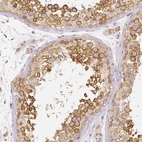 Immunohistochemical staining of human testis shows moderate cytoplasmic positivity in cells in seminiferous ducts.