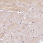 Immunohistochemical staining of human skeletal muscle shows only very weak cytoplasmic positivity in striated muscle fibers.
