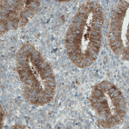 Anti-DIAPH2 Antibody