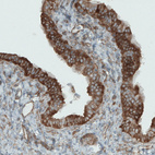 Anti-DIAPH2 Antibody