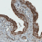 Immunohistochemical staining of human fallopian tube shows strong cytoplasmic positivity in epithelial cells.