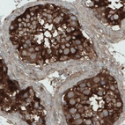 Immunohistochemical staining of human testis shows strong cytoplasmic immunoreactivity in seminiferous tubules cells.