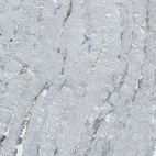 Immunohistochemical staining of human skeletal muscle shows absence of immunoreactivity (negative control).