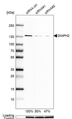 Anti-DIAPH2 Antibody