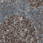 Anti-MCL1 Antibody