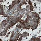 Anti-MCL1 Antibody