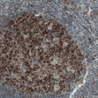Immunohistochemical staining of lymph node in human colon shows strong positivity in the reaction centrum.