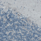 Anti-MCL1 Antibody