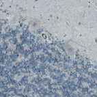 Immunohistochemical staining of human cerebellum shows absence of immunoreactivity (negative control).