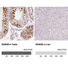 Anti-KDM5B Antibody