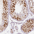 Anti-KDM5B Antibody