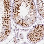 Immunohistochemical staining of human testis shows strong nuclear positivity in cells in seminiferous ducts.