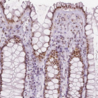 Immunohistochemical staining of human rectum shows moderate nuclear positivity in glandular cells.