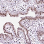 Immunohistochemical staining of human fallopian tube shows moderate nuclear positivity in glandular cells.