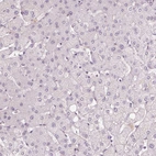 Immunohistochemical staining of human liver shows no positivity in hepatocytes as expected.
