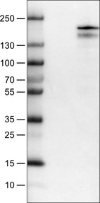 Lane 1: Marker [kDa]_br/_Lane 2: Negative control (vector only transfected HEK293T lysate) _br/_Lane 3: KDM5B Over-expression Lysate (Co-expressed with a C-terminal myc-DDK tag (~3.1 kDa) in mammalian HEK293T cells, LY401985)
