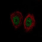 Immunofluorescence staining of MCF7 cells using the Anti-KDM5B monoclonal antibody, showing specific staining in the nucleoplasm in green. Microtubule- and nuclear probes are visualized in red and blue, respectively (where available).
