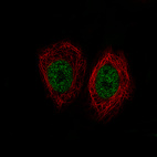 Anti-KDM5B Antibody