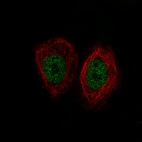 Immunofluorescence staining of MCF7 cells using the Anti-KDM5B monoclonal antibody, showing specific staining in the nucleoplasm in green. Microtubule- and nuclear probes are visualized in red and blue, respectively (where available).