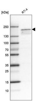 Anti-KDM5B Antibody