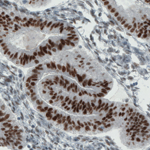 Anti-ESR1 Antibody