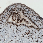 Immunohistochemical staining of human fallopian tube shows strong immunoreactivity in epithelial cells.